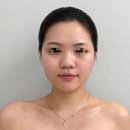 더조은메디칼 | 전주 얼굴경락 여드름 피부까지 개선되는 관리법