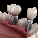 이-바른치과의원 이미지