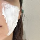 차랑차랑 | 강남역 피부과 쥬베룩볼륨 2회차 솔직후기 (전후사진 O)