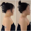 아로아로 | 5.대전 웨딩관리 [아로뮤에스테틱] 승모근관리 후기