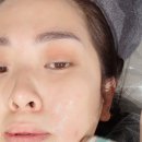 압구정동 에이포의원만의 비통증 쿨링온다리프팅 내돈내산 시술받은 후기예요~