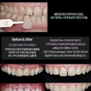 강남덴탈랩 네이버블로그