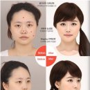 렛미인 이미지