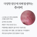 빨간코