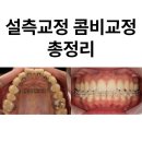 콤비교정 총정리(발음, 불편함, 양치 관리, 안보이는 정도, 치료기간, 인비절라인 비교) 잠실 교정치과