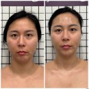 헤어뷰티연구소 | 뷰티케어학과 교수님이 운영하는 해운대에스테틱 작은얼굴관리 윤권희 피부연구소 후기 및 주차