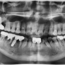 NY치과의원 이미지