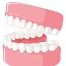 바른이정치과의원 | 꼼꼼한 임플란트시술 중계동 치과 바른이정치과의원