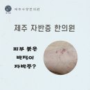 피부 붉은 반점 자반증, 어떤 치료가 필요할까요? 이미지