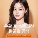 윤곽 후 흐트러진 얼굴의 공식 : 강남 브이리프트로 해결