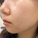 [사당피부관리/사당역피부관리] 천지빛깔 | 피부관리 후기