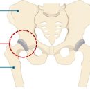 제니스마취통증의학과의원 네이버블로그