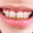 슈어치과교정과치과병원 이미지