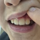 시화센타치과의원 | [내돈 내산 방문후기]​&#34;치료&#34;가 아닌 &#39;예방&#39;에 집중! 용인 더라인치과 구강예방 케어 센터 방문 후기