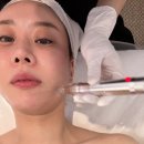 이대 피부관리 오뉴에스테틱 다녀온 후기
