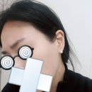 챠밍헤어라인 이미지