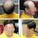 모위드헤어