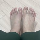 엄지발가락 골절/관절 손상_당일부터 29일차 일기