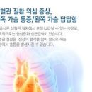 심장 통증 가슴 답답함 나타난타면 협심증 초기 신호 이미지