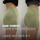 코끼리한의원 | 압구정 도산공원한의원 애플힙 시술 스컬트힙 힙업 4회 솔직 후기 가져왔어요 🖤