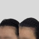 유지도트 | 대전두피문신 도안동 도트바이림에서 깔끔하게 두피관리받고 온 후기