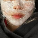 압구정 모공레이저 버츄RF 에이포의원 내돈내산 후기
