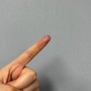 바른소아청소년건강기능식품 | [주사피부염] 스테로이드 대신 프로토픽? 프로토픽0.1% 효능•부작용•실사용 후기