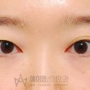 에이엠성형외과의원 이미지