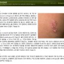 스킨닥터 이미지