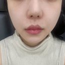 더프라이드성형외과의원 네이버블로그