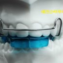 바이오치과기공소 이미지