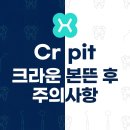 독일치과의원 | 헤리치과 Cr pit 크라운 본뜬 후 주의사항