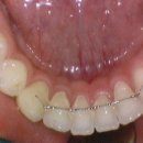 엔도픽스 이미지