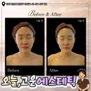 [경기/안산] 오늘,고운에스테틱｜1:1 맞춤 안산예신...대칭까지 맞춰진 솔직 후기 (안산예신관리 필수코스)
