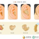 샘보청기 이미지