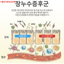 미소이비인후과의원 | 자율신경치료 후기｜장루수 증후군으로 인한 미열·인후통·전신통증이 사라진 이유