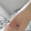 동대구내과의원 네이버블로그