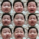 현안과 | 다래끼 짼 후기, 아니 다래끼 수술 후기.. 개아픔/ 중랑구 현안과 원장님 최고👍😭