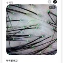 시너지건강디톡