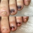 삼도사우나 | 판교 발 관리 전문점에서 내성발톱, 멍든 발톱 케어 찐 후기 | 레푸스 판교점 (feat.홍윤주 부원장님 추천)