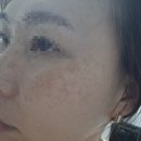 시니그린415 고추냉이잎 앰플세럼-레드, 붉은기 지우개? 2주 사용 솔직 리얼 후기!