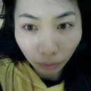바른이빈후과 Daum카페