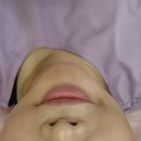 좋은한의원 | 은평구한의원 효과좋은 다이어트 시술 받은 후기