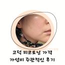 평택 고덕피부과 색소 피코토닝 후기 가격 주기