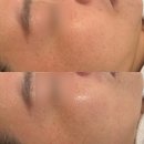 해남군-16 | 해남 피부관리 세라링후기 다온뷰티끄
