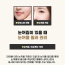 필러 이미지