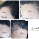 김헤어라인 이미지