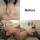 운암초교 | 광주 운암동 동천동 피부관리 잘하는곳 헬로스킨앤바디