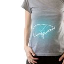 ​C형 간염을 치료하지 않으면 어떤 문제가 생길까? 이미지