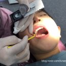 ::지역정보:: &lt;연세아이소망치과&gt;에서 충치치료, 불소도포 했어요.